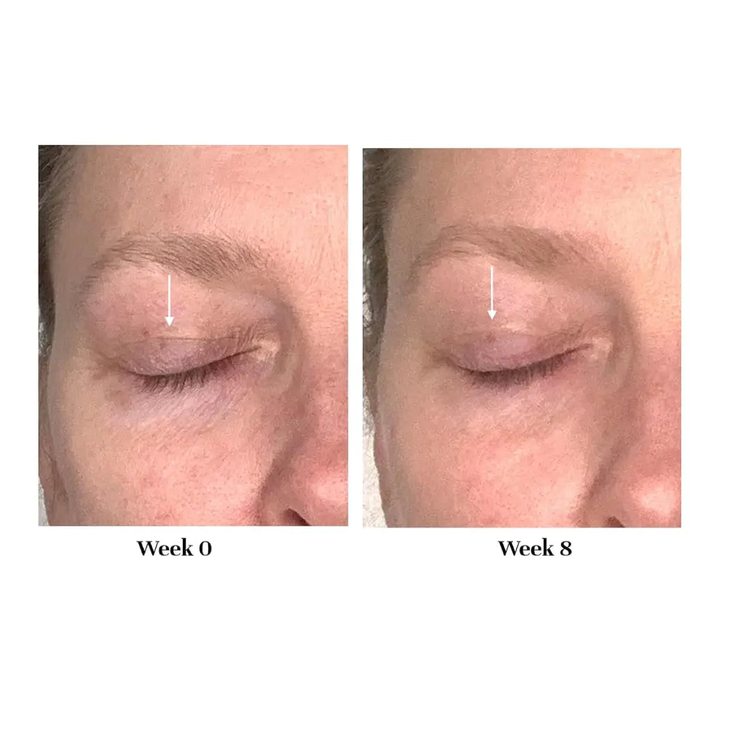 Korvatek Lifting Treatment – Firming Eye Cream for Hooded, Sagging & Crepey Lids – Instantly Smooths Fine Lines & Lifts Appearance – Fragrance-Free Formula