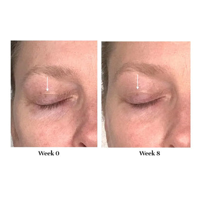 Korvatek Lifting Treatment – Firming Eye Cream for Hooded, Sagging & Crepey Lids – Instantly Smooths Fine Lines & Lifts Appearance – Fragrance-Free Formula